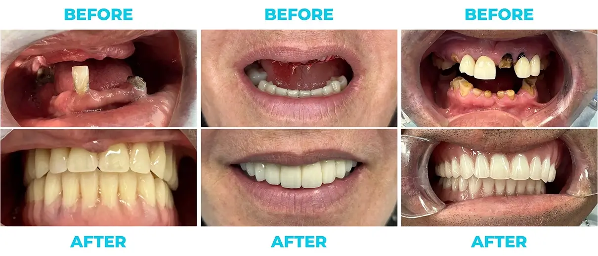 P b&a 1
