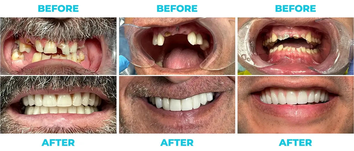 P b&a 2