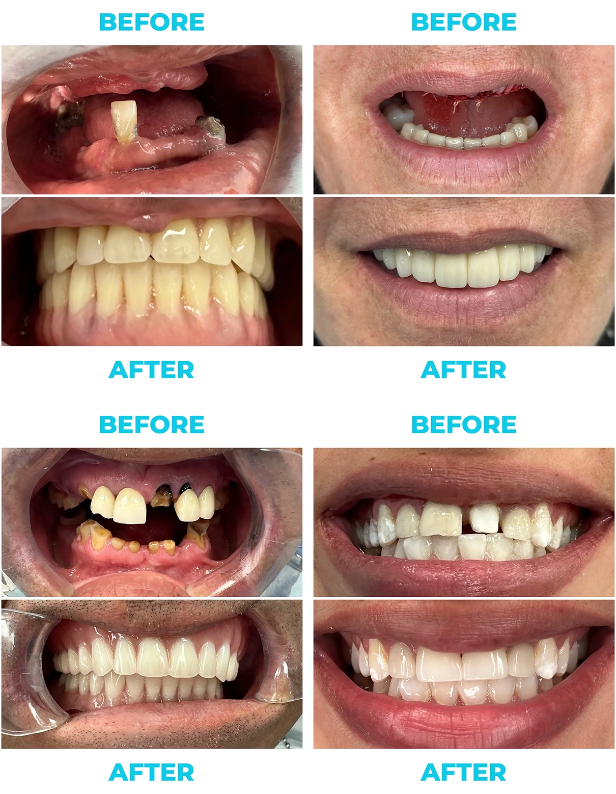 Pp before&after 1@2x