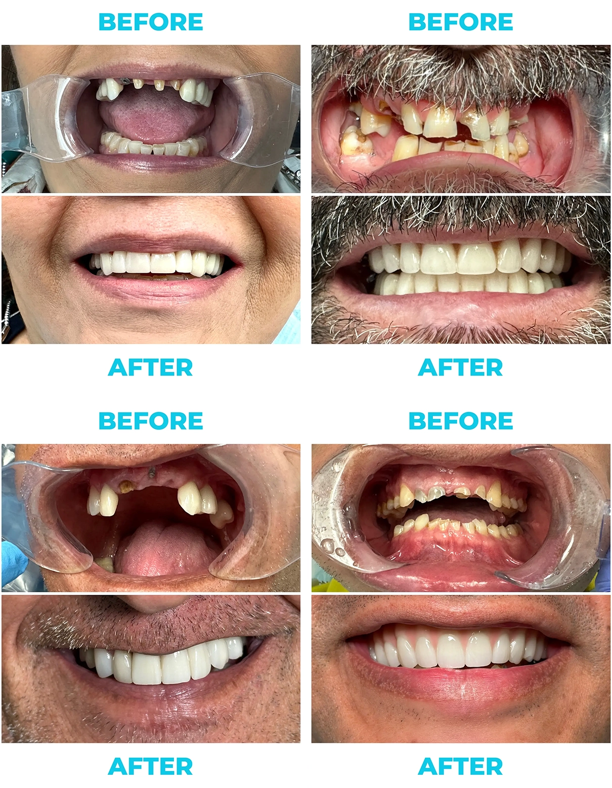 Pp before&after 2@2x