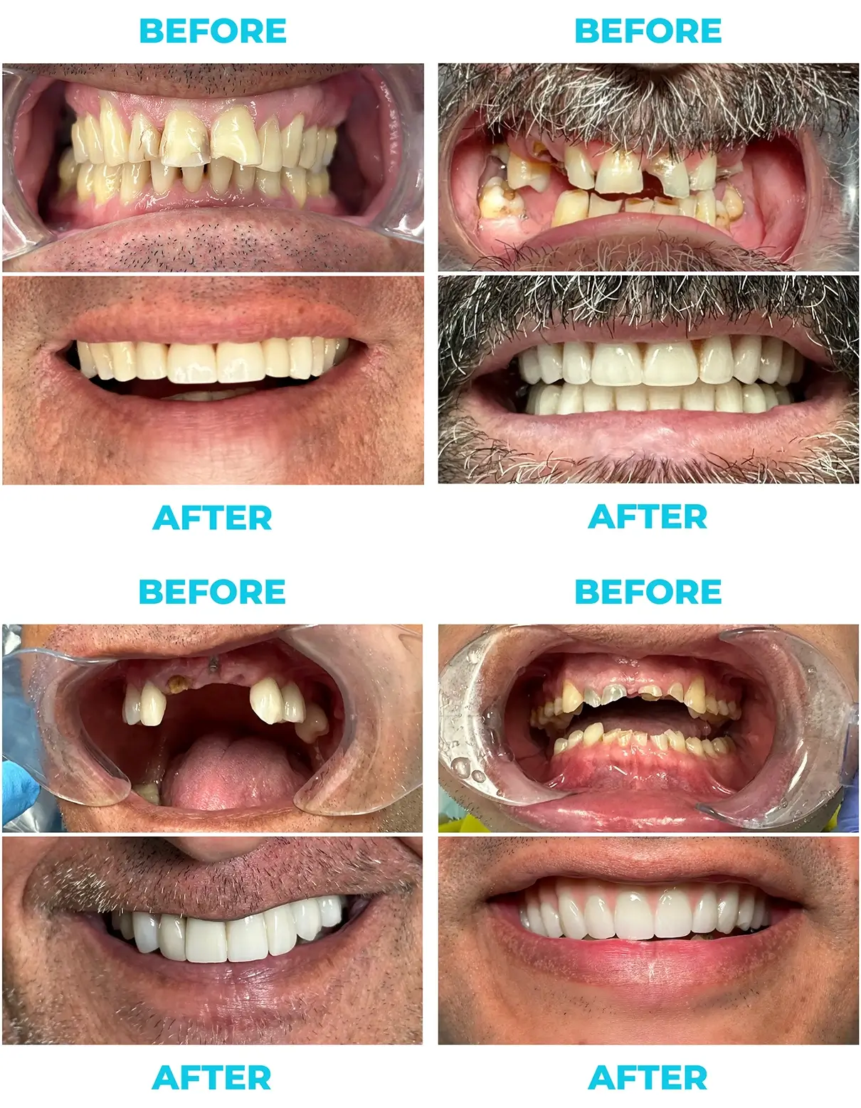 Pp before&after 2a@2x