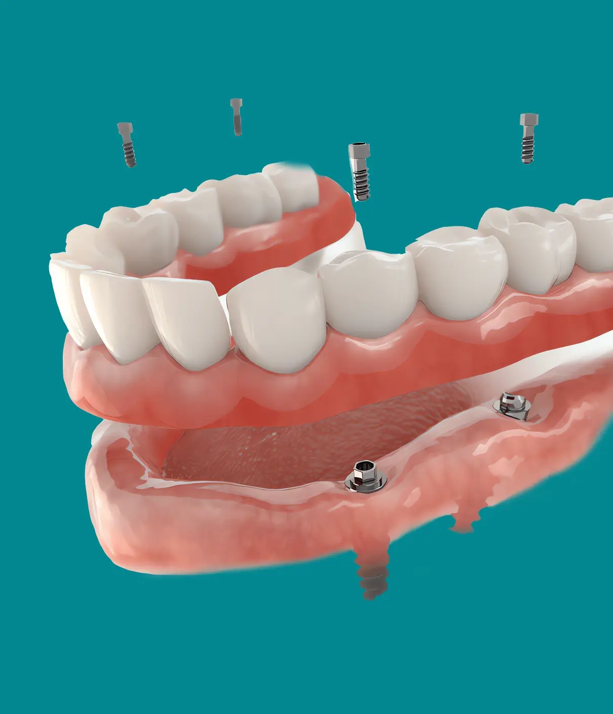 Pembroke zirconia1@2x